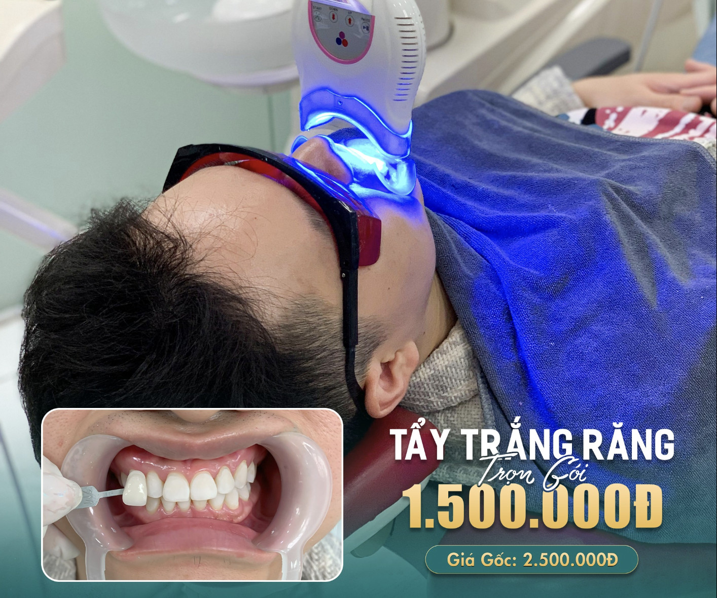dich-vu-tay-trang-rang