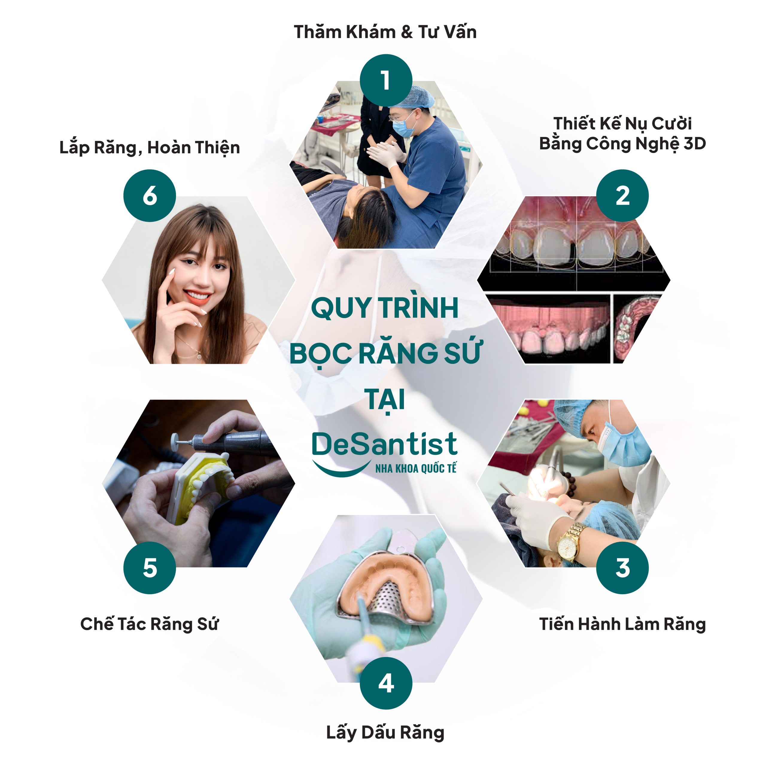quy-trinh-boc-rang-su