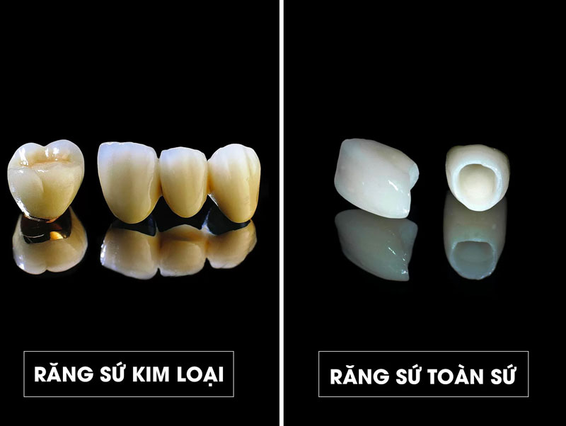 rang-su-co-may-loai